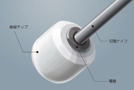 ディスポーザブル高周波ナイフ ITknife nano|製品情報|オリンパス医療ウェブサイト メディカルタウン ディスポーザブル高周波ナイフ ITknife nano|製品情報|オリンパス医療ウェブサイト メディカルタウン